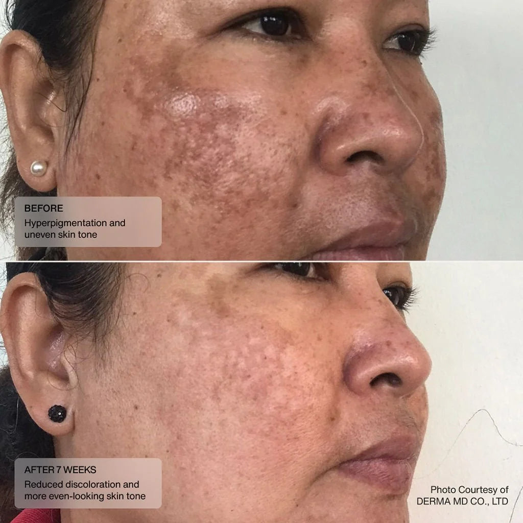 Even Tone Retinol Cream